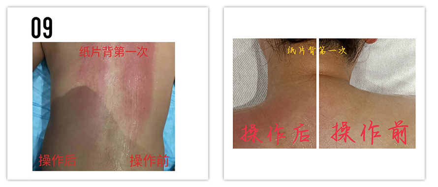 三椎暢活養(yǎng)護(hù)(圖4) 三椎暢活養(yǎng)護(hù)(圖4)