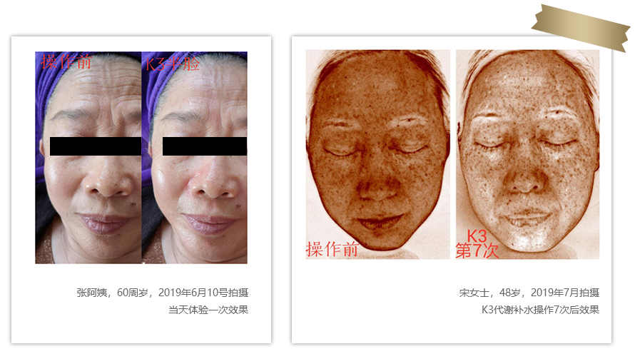 智能量子活膚(圖3) 智能量子活膚(圖3)