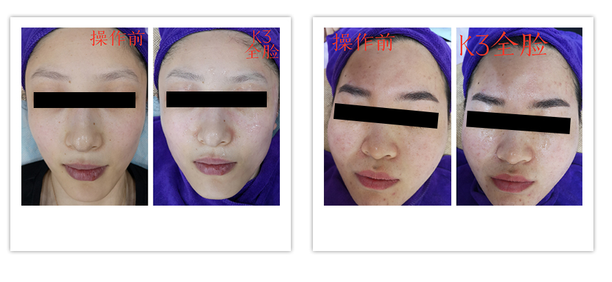 智能量子活膚(圖4) 智能量子活膚(圖4)