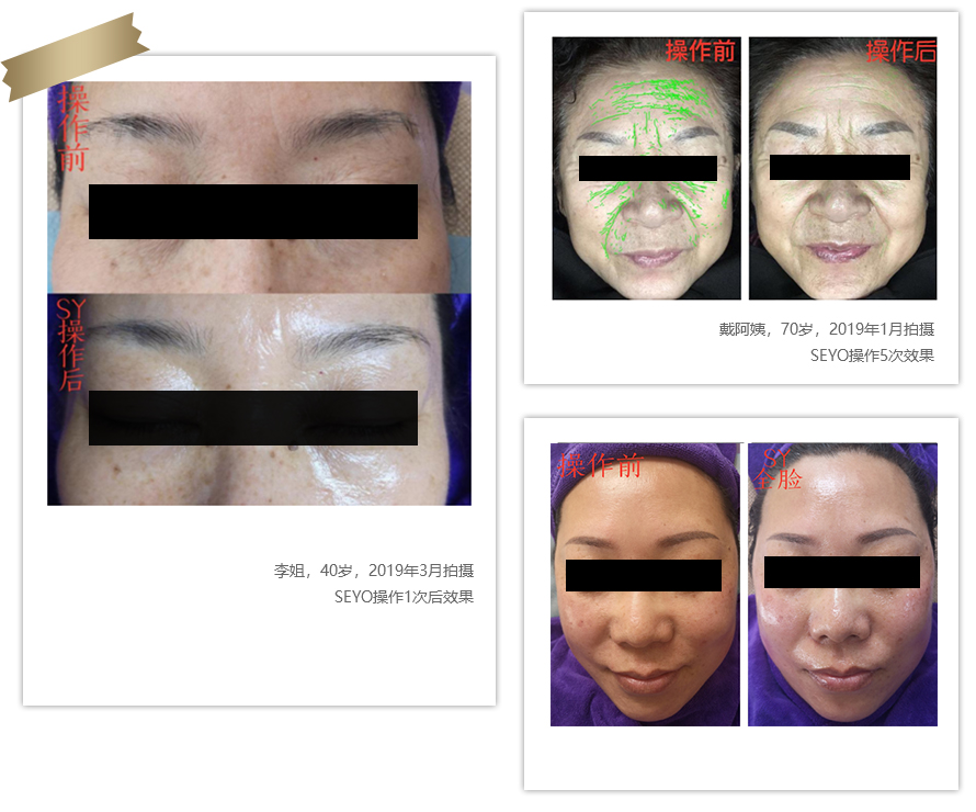 智能細胞童顏護膚(圖3) 智能細胞童顏護膚(圖3)